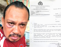 Parah! Hendak Liputan, Wartawan Memorandum di Pamekasan Dianiaya hingga Babak Belur