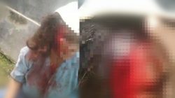 Dahi Robek, Kepala Dipukuli Pakai Keramik, Wanita di Pamekasan Tempuh Jalur Hukum