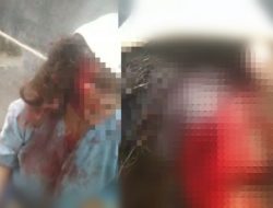 Dahi Robek, Kepala Dipukuli Pakai Keramik, Wanita di Pamekasan Tempuh Jalur Hukum