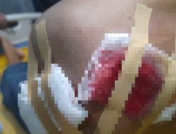 Geger di Pamekasan! Oknum Kiai Dilaporkan ke Polisi, Diduga Bacok Korban dengan Celurit